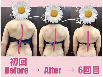 スワン 新栄店(SWAN)/背骨の歪みに悩む方必見！！