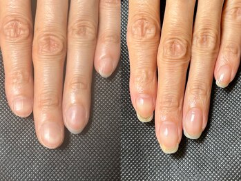 地爪育成 最強ネイルケアコース