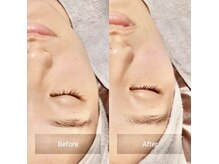 ジョリ(joli)の雰囲気（小顔フェイシャルエステでフェイスラインをスッキリと。）