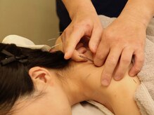 寝屋川かわい鍼灸整骨院/慢性的な肩こりの改善に