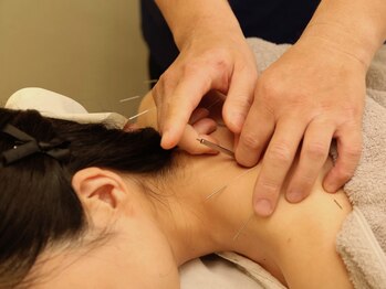 寝屋川かわい鍼灸整骨院/慢性的な肩こりの改善に