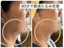 エバーグリーン(Evergreen)