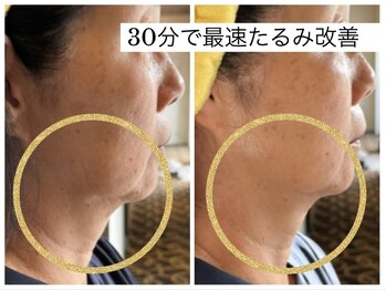 エバーグリーン(Evergreen)