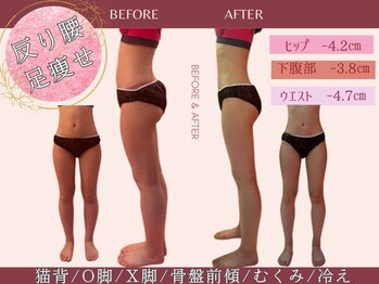 骨盤ちゃん 上越モール店の写真/ダイエットに苦戦してる人へ！頑張ってるけど痩せない人、骨盤から整えてリバウンド知らずのボディへ☆