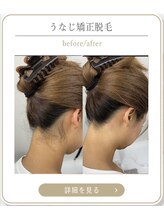 ミース 上野店/施術の変化をチェック