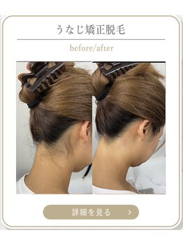 ミース 上野店/施術の変化をチェック