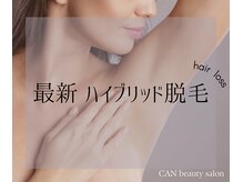 キャンビューティーサロン 金山店(CAN beauty salon)の雰囲気（最先端《ハイブリッド脱毛》都度払い/全身脱毛/VIO脱毛）