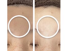 ナナマルニ 高知店(702)/トーンＵＰ★