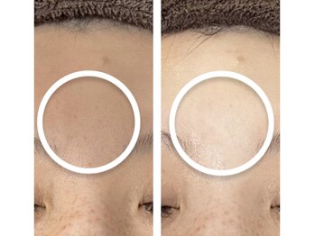 ナナマルニ 高知店(702)/トーンＵＰ★