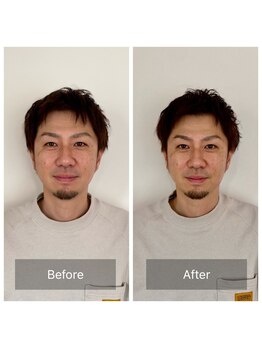 ハリラボ(hari Lab.)/【お客様の声】