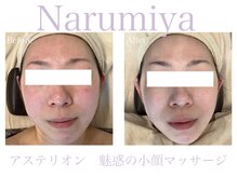 トータルチェンジエステ ナルミヤ(total change esthe Narumiya)/5.ビフォーアフター