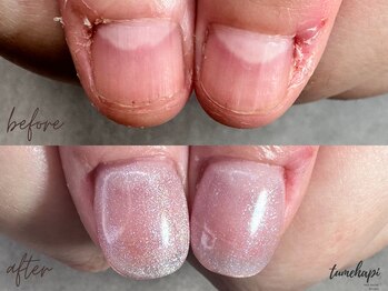 ツメハピ(tumehapi)/長さだし+マグネット