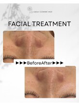 サロン コムモア(salon COMME MOI)/【BeforeAfter】
