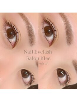 クレー(Klee)/ラッシュリフト