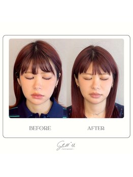 Still U 渋谷の写真/顔の骨格と筋肉へアプローチ!小顔矯正だから出せる変化を。史上最高の小顔に!あなたの“なりたい”を叶える