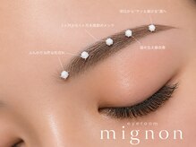 アイルーム ミニョン(eyeroom mignon)