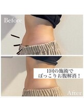 グランデ(Grande)/腸セラピー/腸活/腸もみ