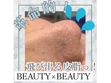 ビューティービューティー(beauty×beauty)