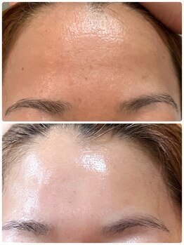 アンパス(Unpas)/褒められ肌作りしませんか♪