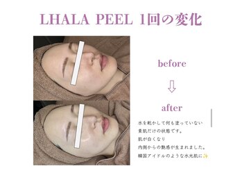 ベル(BELL)/美白・水光肌になりたい方へ