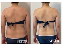 イリゼ(IRISER)/【20代ブライダル】華奢な背中へ