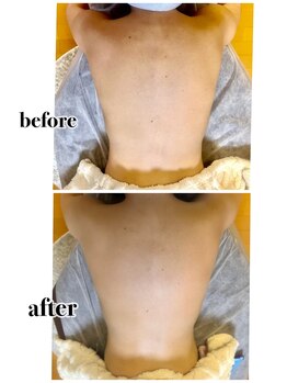 メル(MeRu)/全身リンパマッサージ