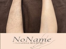 ノーネーム(No Name)