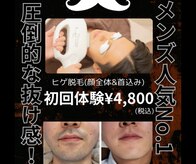 グロワール(gloire)