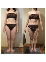 サロン ド ディジェール(Salon de Degel)/3回目上半身集中/経過測定エステ