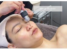 ポンテ ダイマル(Ponte DAIMARU)/毛穴洗浄