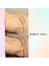 レ サロン(les SALON)/WINBACK/お腹/ウエスト/腸活