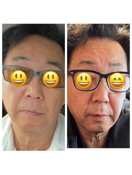 ココスタイルビューティー(COCOSTYLE beauty)/最新リフトアップ