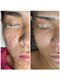 ソワラ(Soiela)の写真/ハーブピーリングでニキビ・毛穴レスな肌へ!憧れの透明感肌を体験◎ フェイシャル/札幌/清田区