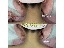 シルク(Cilk)の雰囲気(うなじ美人に★ちゅるんと美肌脱毛!)