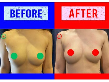 セブンシーズ 上野店(Seven Seas)/自己努力は保湿のみ[バストケア]