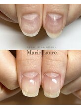マリーロール 天王寺店(Marie Laure)/自爪育成/深爪矯正/ネイルケア