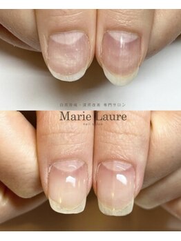 マリーロール 天王寺店(Marie Laure)/自爪育成/深爪矯正/ネイルケア