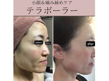 ドマーニ(Domani)の雰囲気（頭蓋骨からアプローチする小顔調整も人気♪頭の大きさの変化も◎）