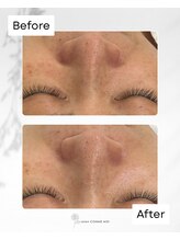 サロン コムモア(salon COMME MOI)/【BeforeAfter】