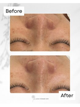 サロン コムモア(salon COMME MOI)/【BeforeAfter】