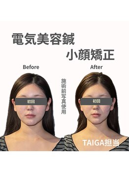 クリアランス(CLEARANCE)/施術回数1回　TAIGA担当