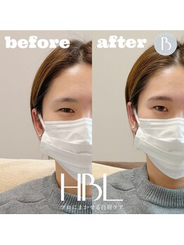 トゥルヌソル 宇都宮(tournesol)/ハリウッドブロウリフト