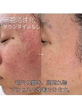 ラシュシュ(La chou chou)/プロセルフェイシャル