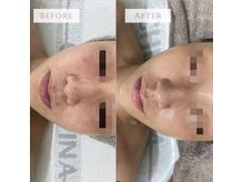 リリードボーテ 高槻店(LILY DE BEAUTE)の雰囲気（お肌のお悩み気軽にご相談ください）