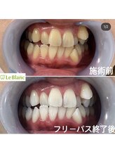 ルブラン 奈良店(Le Blanc)/清潔感を手に入れましょう！