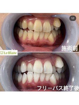 ルブラン 奈良店(Le Blanc)/清潔感を手に入れましょう！