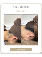ミース 上野店/うなじ脱毛で清潔感UP