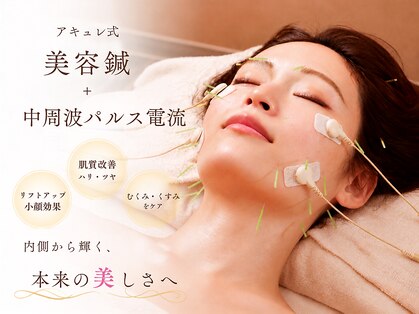 アキュレ(Acure)の写真
