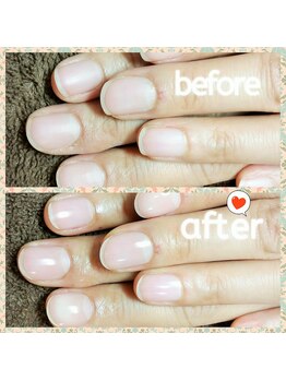 ロイ(ROI)/ハンドケア☆