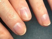 オーラリー ネイル アート メゾン(ORRERY nail art maison)/ハンド / 深爪ケア